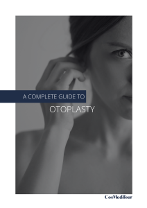 otoplasty guide