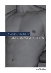 Guide to gynecomastia surgery