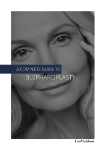 A complete guide to blepharoplasty