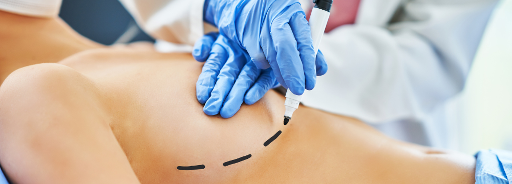 What is the difference between plastic surgeons and cosmetic surgeons?