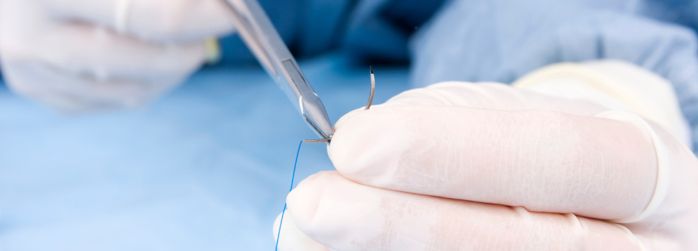 Dissolvable Stitches: How Long They Last, Complications, Care