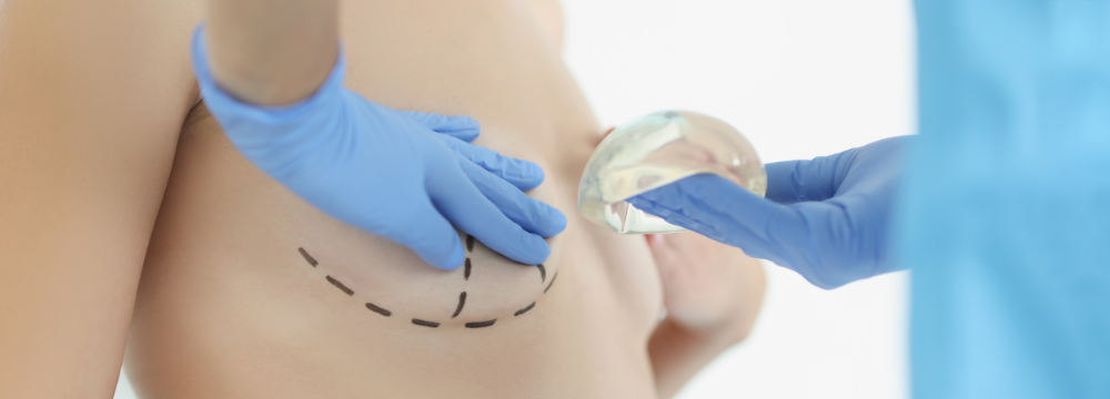 Woman receiving a Two-Stage Breast Lift and Breast Augmentation