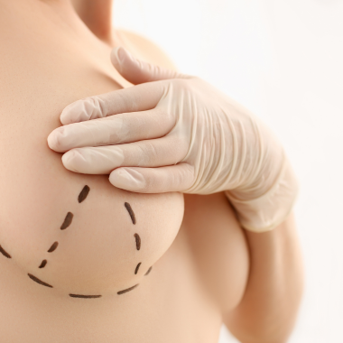 Plastic Surgery Images of woman before a Breast lift