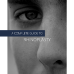 Rhinoplasty Australia. Nose Job Australia. Rhinoplasty cost Australia. Rhinoplasty price. Nose job cost. 